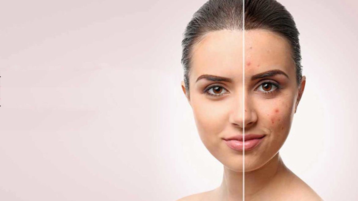 ژل‌ها یا ورقه‌های سیلیکونی